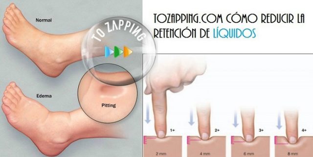 Tozapping Como Reducir La Retencion De Liquidos 736x369 Tozapping